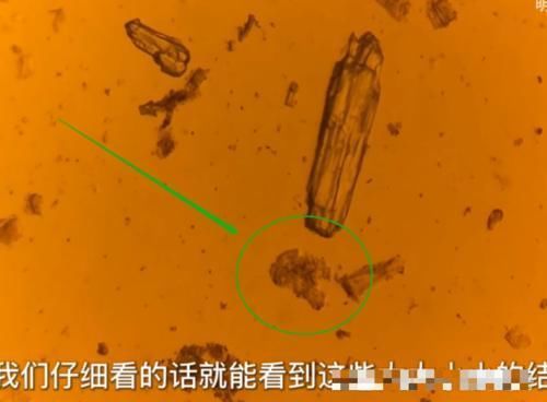 老干妈里面|小伙将老干妈放大400倍!密密麻麻都是这东西,网友:再也不吃了!