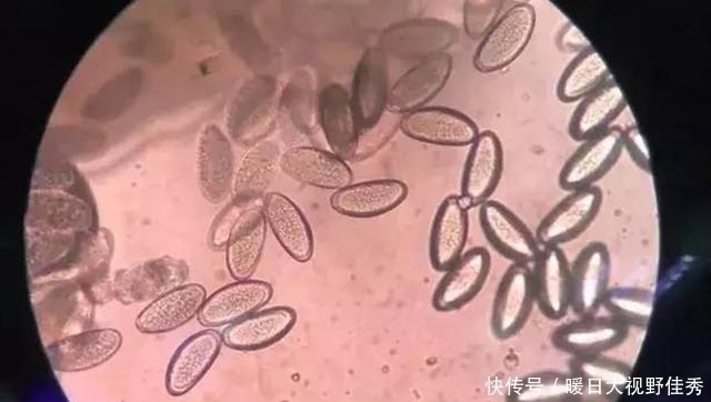  晚上|4岁宝宝晚上哭闹说“屁屁痒”，家长脱下裤子一看，什么东西在动