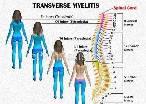 玛莉卡|英国11岁女孩患“百万分之一”机率的罕见病,胸部以下全瘫痪