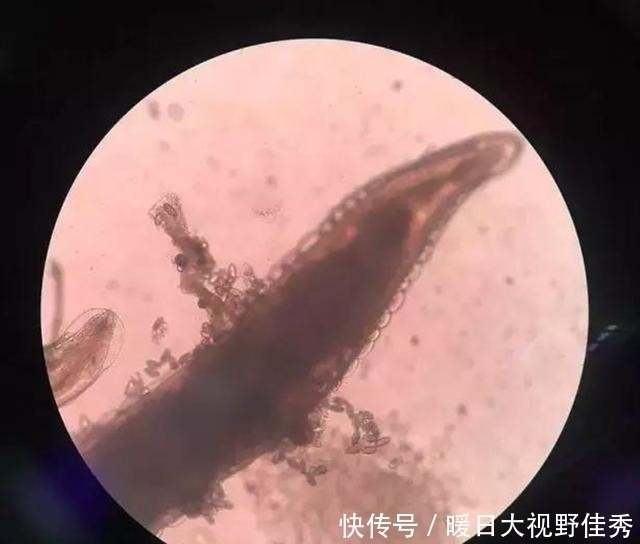 晚上|4岁宝宝晚上哭闹说“屁屁痒”,家长脱下裤子一看,什么东西在动