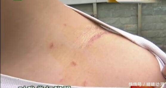 拳打脚踢|13岁小孩被一群广场舞大妈围殴，拳打脚踢，小孩：不还手，没天理