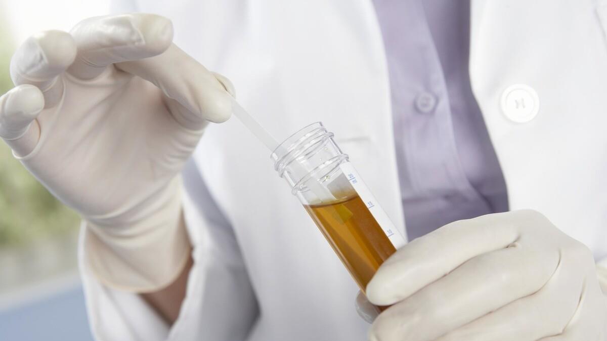  医生|奥运冠军吴敏霞老公住进ICU病房，因这种食物吃多了！医生解读