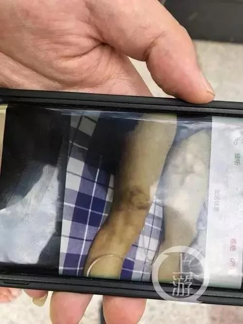 男童|女医生泳池内被13岁男童性骚扰，事后被人肉，导致自杀网友怒了