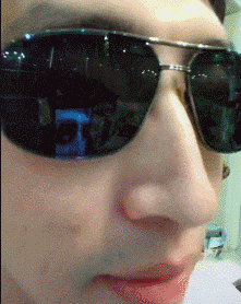  搞笑|搞笑GIF：护士姐姐你下手轻点，我怕疼