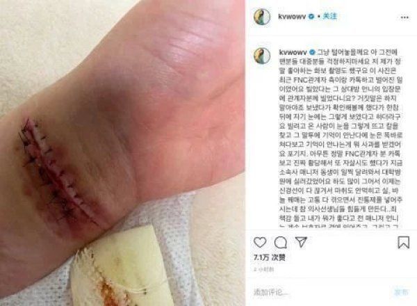 割腕|没有一片雪花是无辜的权珉娥再次自杀送医割腕太多次神经断裂