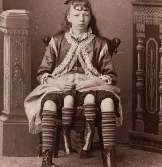  与众不同|她出生就有四条腿，爹妈用她来赚钱养家，死后墓地与众不同