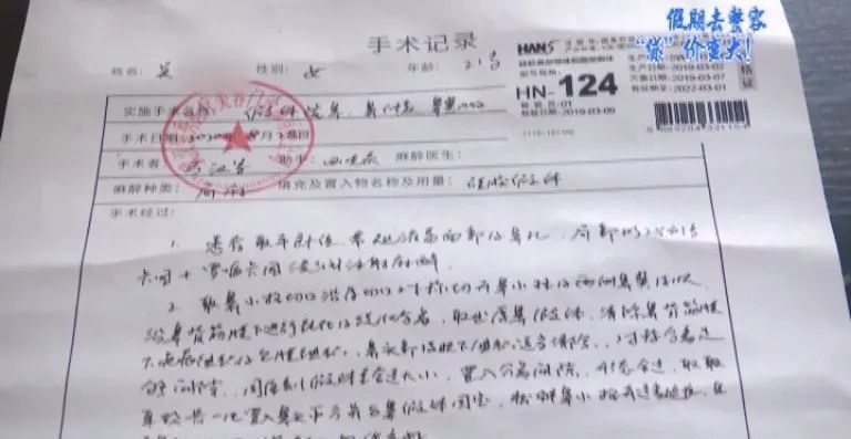 贷款|女大学生偷偷贷款整容,妈妈怒了“没有偿还能力是如何放贷的?”