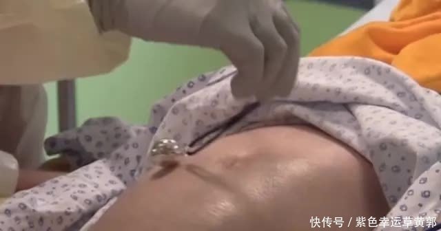 诞下|脑死亡117天后，27岁孕妇诞下女婴，家属同意关掉呼吸机