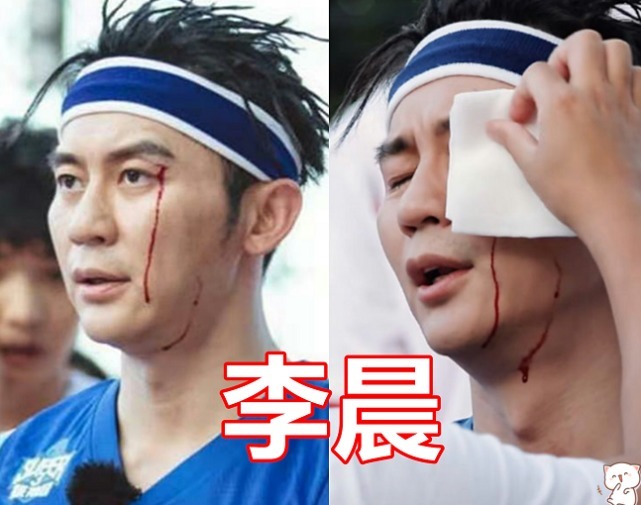  心疼|录制跑男有多危险李晨曾被篮球砸到眉毛，看到baby我心疼了