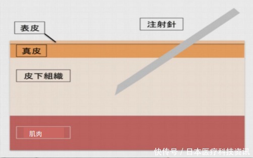 治疗|日本最先端保养品,干细胞上清液!