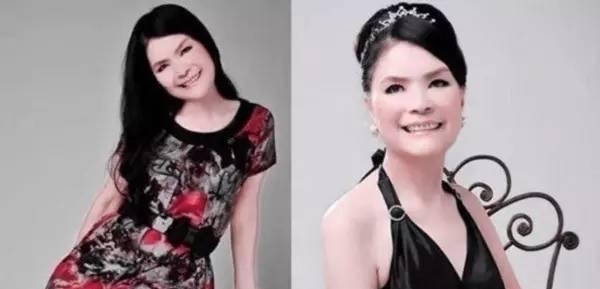 整容|62岁老奶奶花巨资整容10次,只为让自己变得像赵雅芝一样美