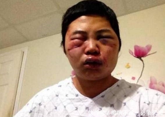 作死|男子作死用高压水枪弄马蜂窝，结果男子后悔不已险些丢命！