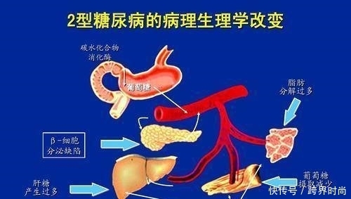  糖尿病|干货；糖尿病能治好吗？患病10年的糖友道出你想要的4个真相