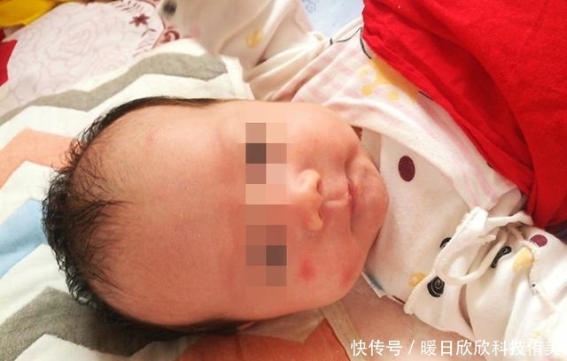 蚊子|夏季,孩子最讨厌的并不是高温,而是这四件事!